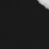 SleepApnea_